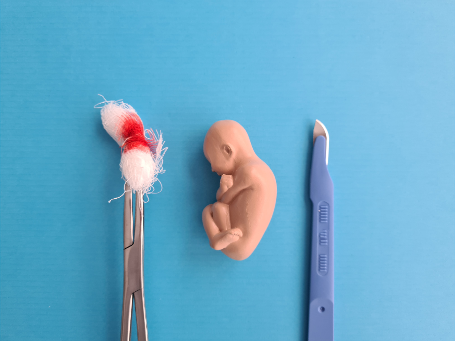 Abortion: A Constitutional Right?